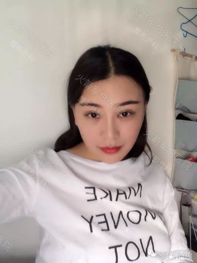 https://img.miyanlife.com/mnt/timg/180127/1101202428-9.jpg