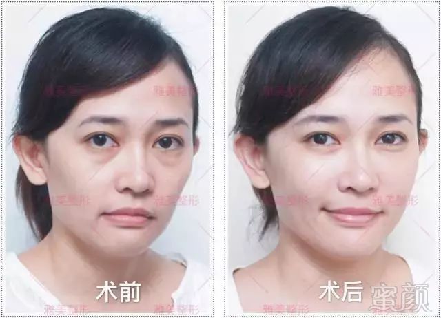 https://img.miyanlife.com/mnt/timg/180127/1109303Z1-4.jpg
