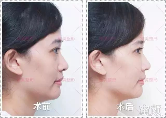 https://img.miyanlife.com/mnt/timg/180127/110930K19-5.jpg