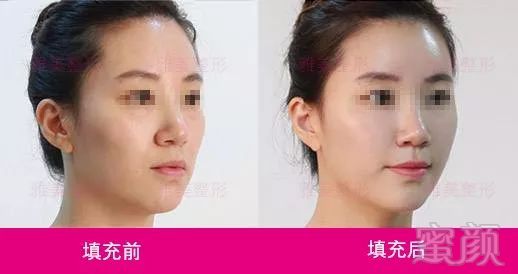 https://img.miyanlife.com/mnt/timg/180127/110930O17-3.jpg
