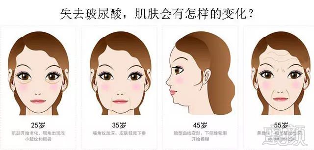 https://img.miyanlife.com/mnt/timg/180127/11131215V-2.jpg