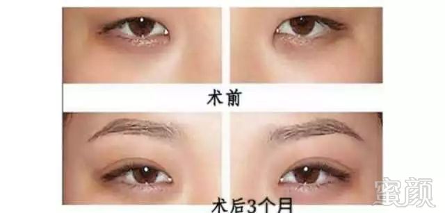 https://img.miyanlife.com/mnt/timg/180127/11161053b-2.jpg