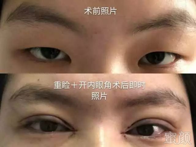 https://img.miyanlife.com/mnt/timg/180127/111610ET-1.jpg