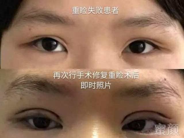 https://img.miyanlife.com/mnt/timg/180127/111610L04-3.jpg
