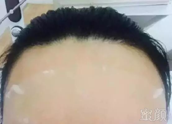 https://img.miyanlife.com/mnt/timg/180127/1121592H5-1.jpg