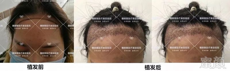https://img.miyanlife.com/mnt/timg/180127/11220344G-6.jpg