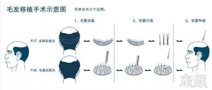https://img.miyanlife.com/mnt/timg/180127/1122036463-5.jpg