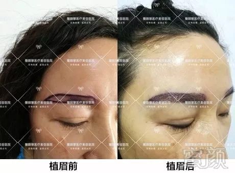https://img.miyanlife.com/mnt/timg/180127/1122046141-9.jpg