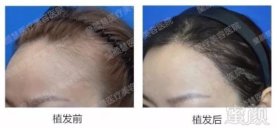 https://img.miyanlife.com/mnt/timg/180127/1122052U1-13.jpg