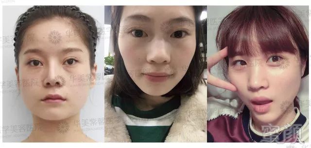 https://img.miyanlife.com/mnt/timg/180127/11294CB3-1.jpg