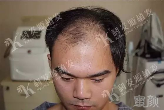 https://img.miyanlife.com/mnt/timg/180127/1233422G7-1.jpg