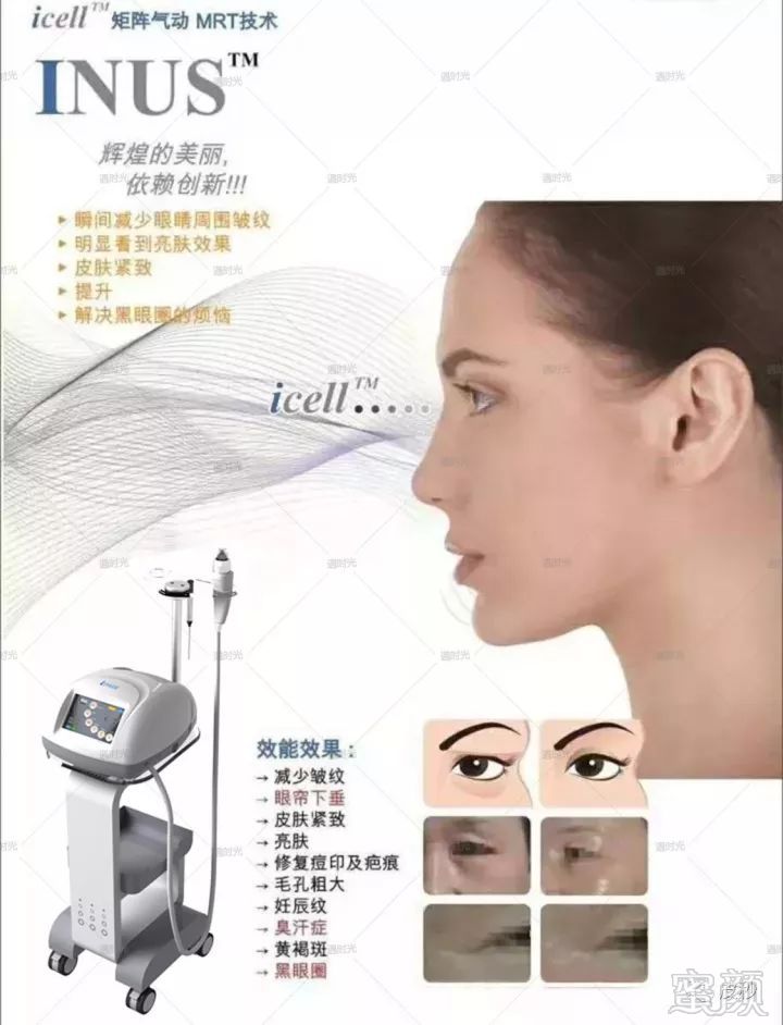 https://img.miyanlife.com/mnt/timg/180127/123515I27-3.jpg