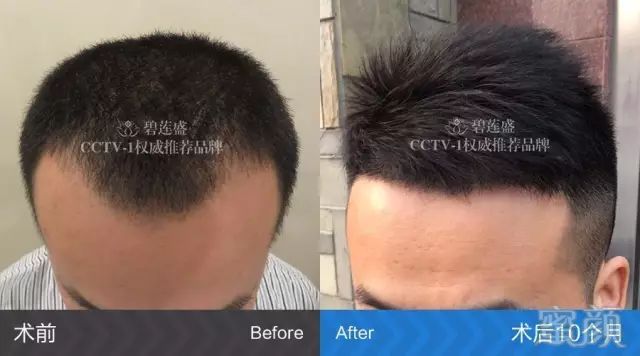 https://img.miyanlife.com/mnt/timg/180127/123Q45335-4.jpg