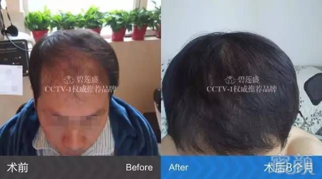 https://img.miyanlife.com/mnt/timg/180127/123Q45b3-6.jpg
