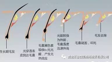 https://img.miyanlife.com/mnt/timg/180127/124Z01629-3.jpg