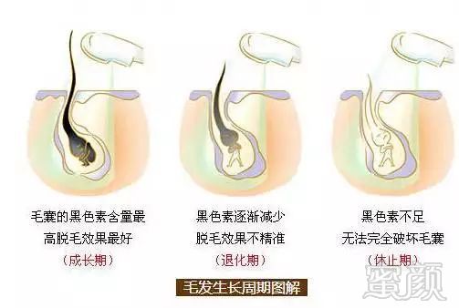 https://img.miyanlife.com/mnt/timg/180128/0934244108-0.jpg