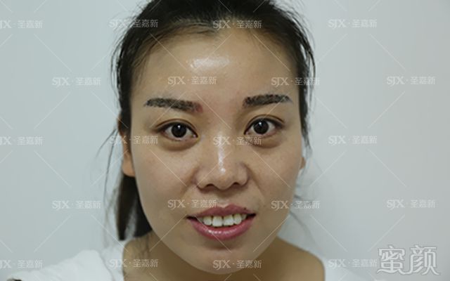https://img.miyanlife.com/mnt/timg/180128/0935595T7-5.jpg