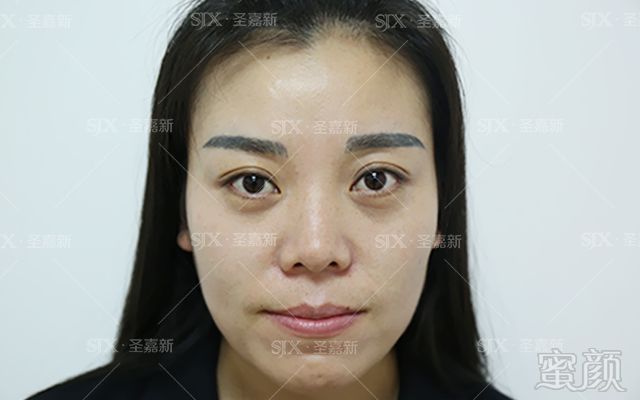 https://img.miyanlife.com/mnt/timg/180128/09355SS2-0.jpg