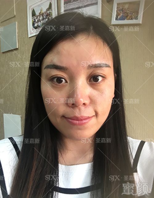 https://img.miyanlife.com/mnt/timg/180128/09355a640-6.jpg