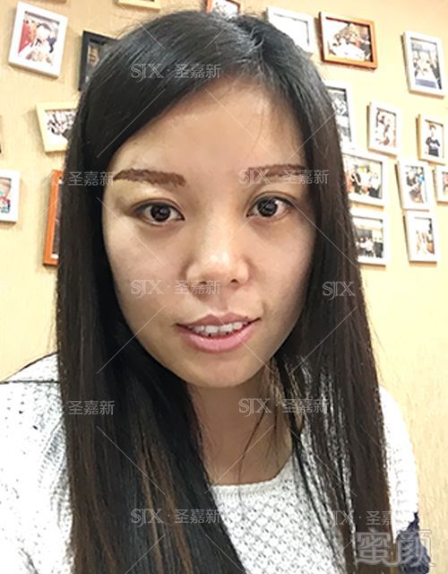https://img.miyanlife.com/mnt/timg/180128/0936003I7-9.jpg