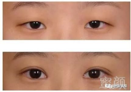 https://img.miyanlife.com/mnt/timg/180128/10031Q164-3.jpg