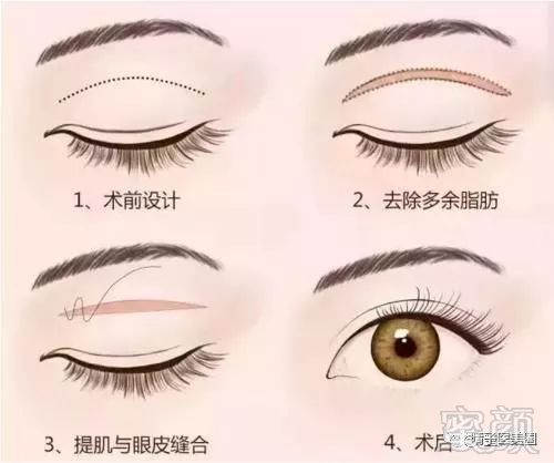 https://img.miyanlife.com/mnt/timg/180128/10031U408-1.jpg