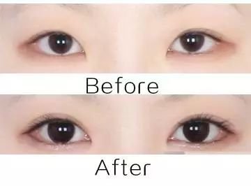 https://img.miyanlife.com/mnt/timg/180128/1014442Q2-2.jpg