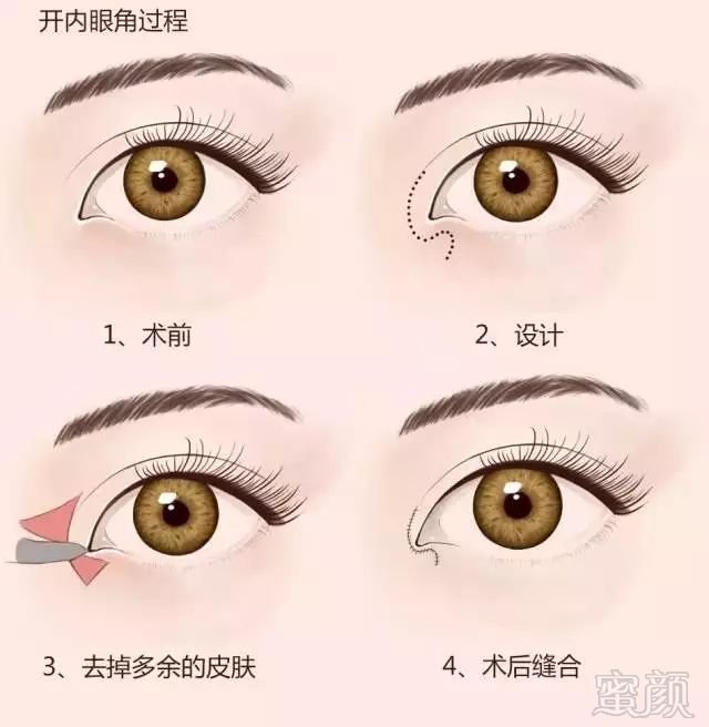 https://img.miyanlife.com/mnt/timg/180128/1014443R4-1.jpg