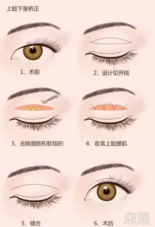 https://img.miyanlife.com/mnt/timg/180128/1014451642-3.jpg