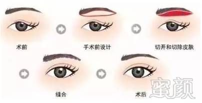 https://img.miyanlife.com/mnt/timg/180128/10144A0A-5.jpg