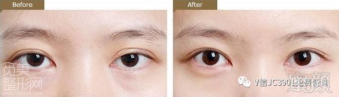 https://img.miyanlife.com/mnt/timg/180128/103P61M1-0.jpg