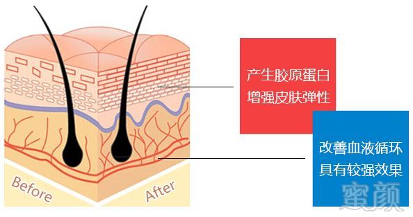 案例图片