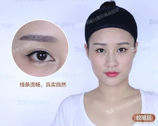 https://img.miyanlife.com/mnt/timg/180128/110F64230-6.jpg