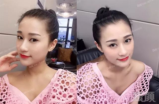 https://img.miyanlife.com/mnt/timg/180128/110FBF9-7.jpg