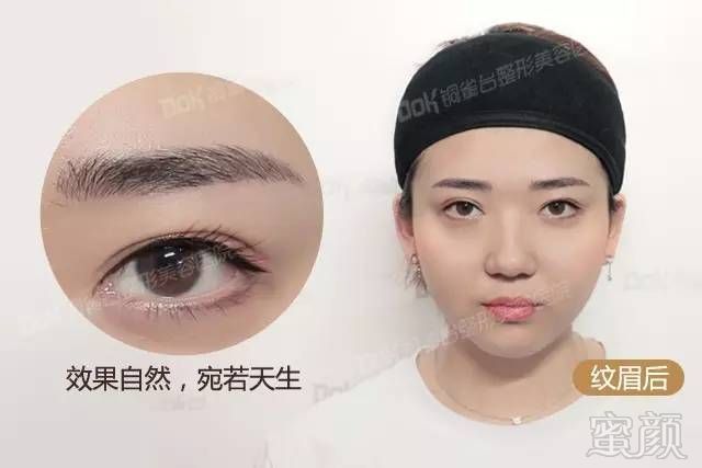 https://img.miyanlife.com/mnt/timg/180128/110FM549-9.jpg