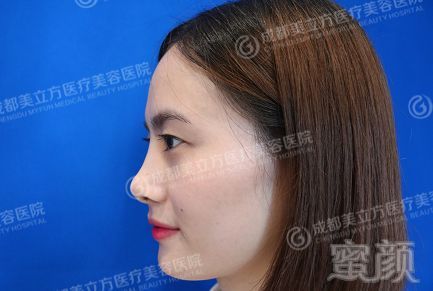 https://img.miyanlife.com/mnt/timg/180128/1112594338-2.jpg