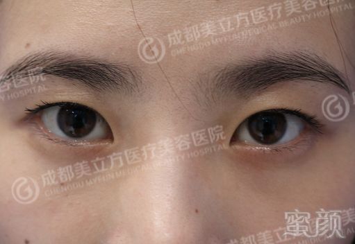 https://img.miyanlife.com/mnt/timg/180128/111259E36-3.jpg