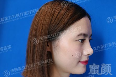 https://img.miyanlife.com/mnt/timg/180128/11125TK5-1.jpg