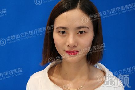 https://img.miyanlife.com/mnt/timg/180128/11125UE8-0.jpg