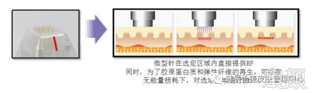 https://img.miyanlife.com/mnt/timg/180128/111J34348-2.jpg