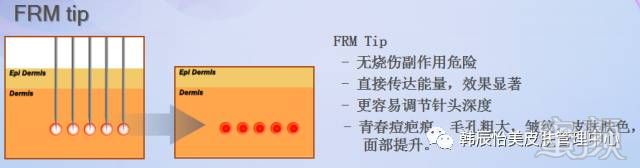 https://img.miyanlife.com/mnt/timg/180128/111J53420-10.jpg