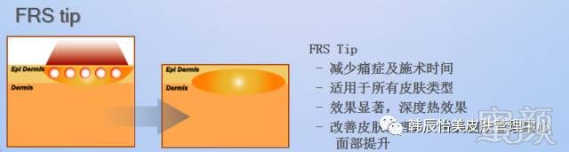 https://img.miyanlife.com/mnt/timg/180128/111J5OE-11.jpg