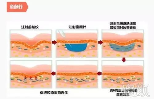 案例图片