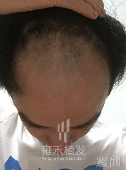 https://img.miyanlife.com/mnt/timg/180128/13051I254-1.jpg