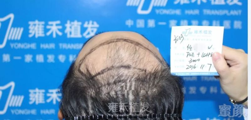 https://img.miyanlife.com/mnt/timg/180128/13051U055-3.jpg
