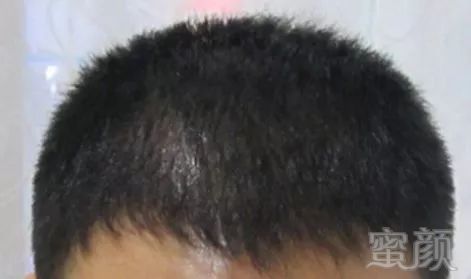https://img.miyanlife.com/mnt/timg/180128/13193C2S-3.jpg