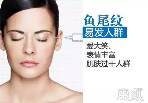 https://img.miyanlife.com/mnt/timg/180128/15105TC5-4.jpg