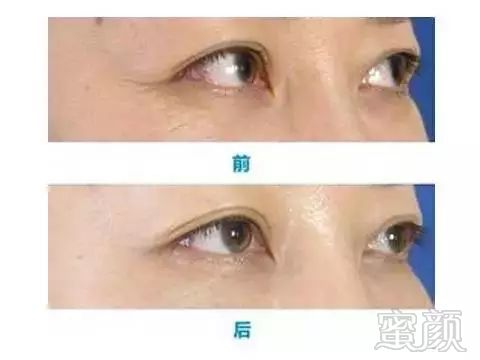 https://img.miyanlife.com/mnt/timg/180128/15105U360-6.jpg