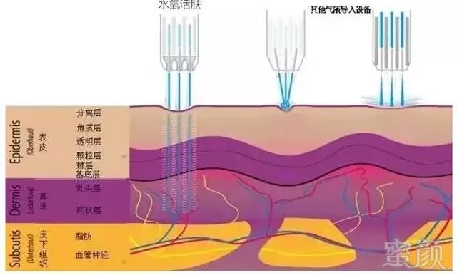 案例图片