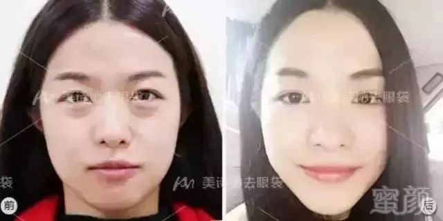 案例图片